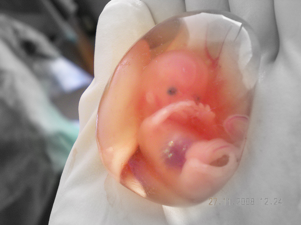 Human_fetus_10_weeks_-_therapeutic_abortion